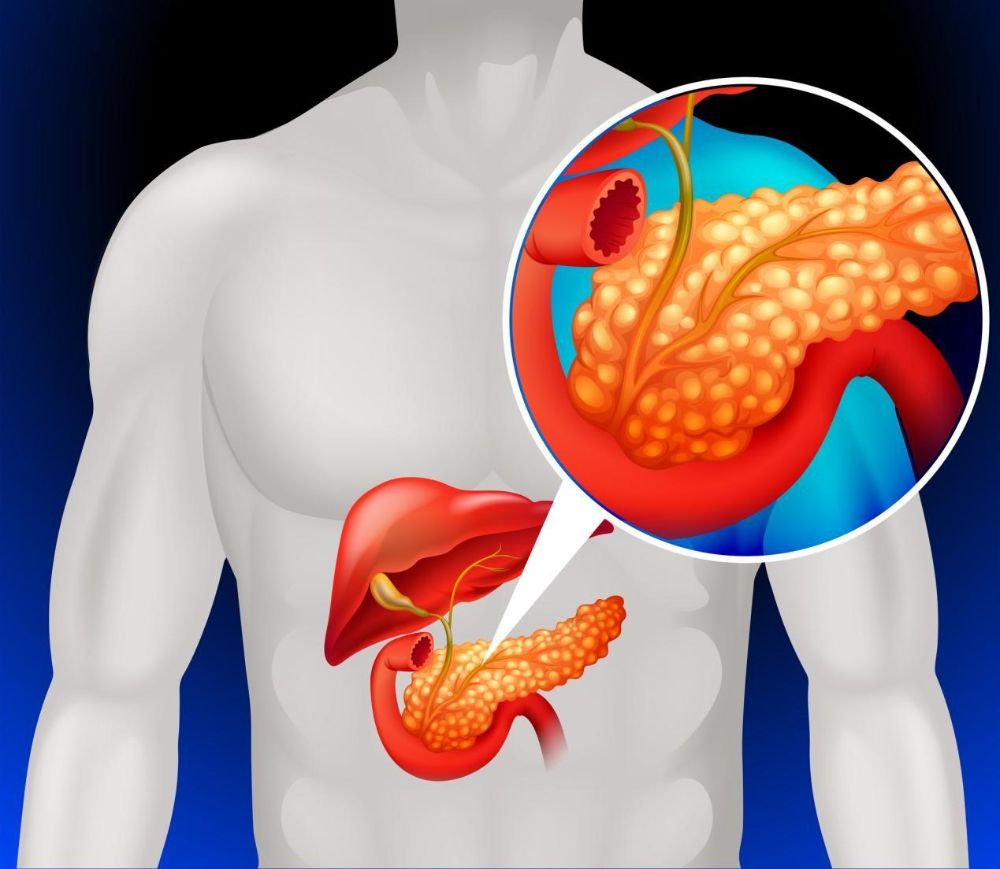 Pancreatic Cancer Surgery in West Delhi