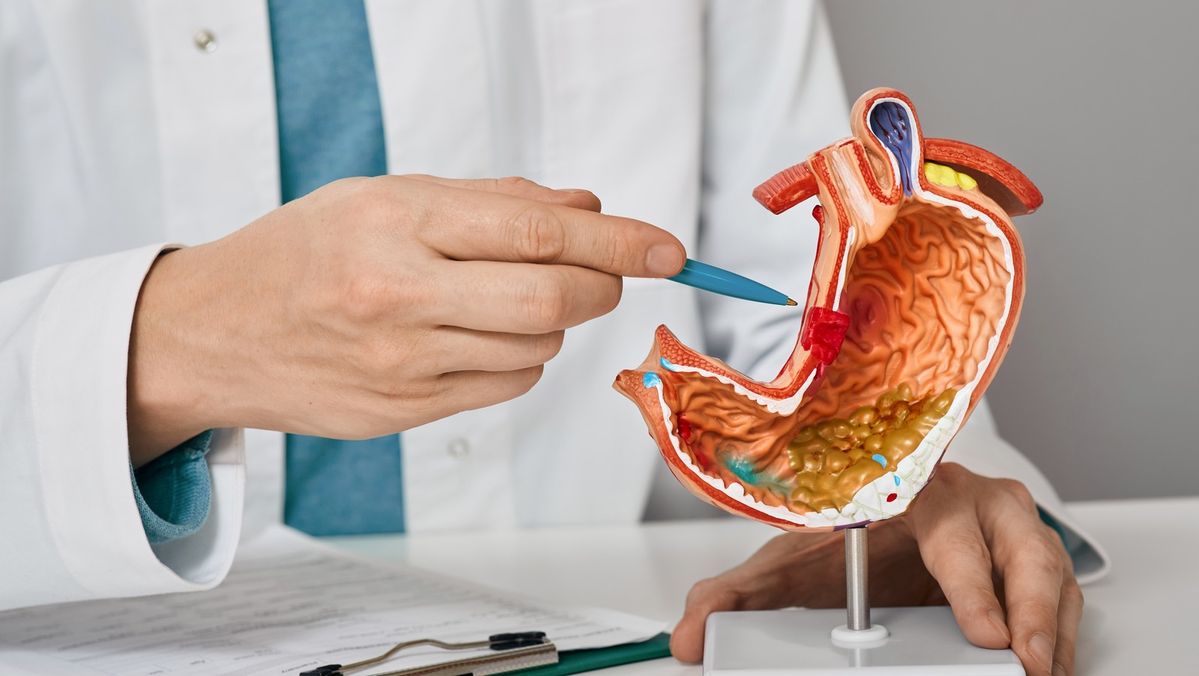 Stomach Cancer Surgery in West Delhi